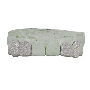 Grilles dentaires personnalisées en or massif serties de diamants de moissanite VVS, style hip-hop, avec un motif en zigzag - Product Image 1