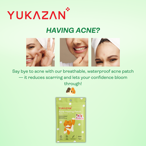 Pansements hydrocolloïdes pour l'acné Yukazan Savvy Kitty, 30 unités, marque malaisienne, design attrayant, respirants, résistants à l'eau - Product Image 3
