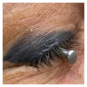 Protection oculaire pour chirurgie laser / Protection oculaire sclérale - Instruments de sécurité |   acier inoxydable ou de qualité médicale |   non-réfléchissant - Product Image 6
