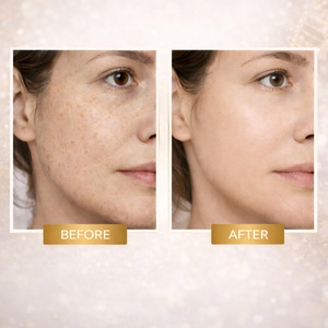 PDRN <b>Bounce</b> <b>Ball</b> Serum 40ml 100,000 ppm Concentrated Serum <b>Balls</b> OEM/ODM Whitening and Reducing fine lines elastin essence - Product Image 5