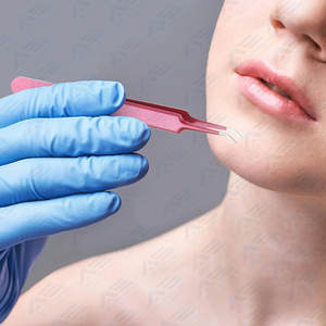 เข็มดูดสิวและสิวเครื่องมือทำความสะอาดใบหน้าสำหรับกำจัดสิวหัวดำและสิวทำจากสเตนเลสสตีล - Product Image 4