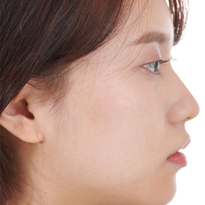 Korea EZ Touch Natural Calm 10mm - Tea <b>Tree</b> & Cica Soothing Invisible Hydrocolloid Acne Pimple Patch - Product Image 4