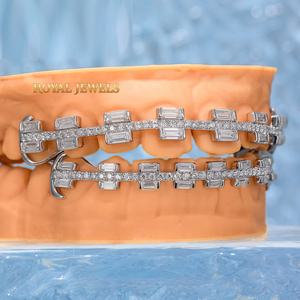 Grillz Dentales Personalizados de Plata 925 con Diamantes Moissanita VVS y Esmeraldas Redondas Estilo Hip Hop - Product Image 3