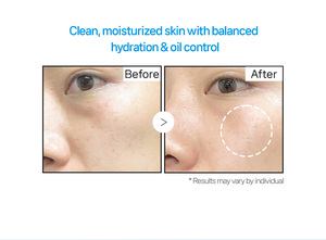 บลู เพทัล ไฮเดรติ้ง เจล คลีนเซอร์ เจนเทิล เฟเชียล คลีนเซอร์ ทำความสะอาดล้ำลึก ให้ความชุ่มชื้น ลดรอยสิว ล้างหน้าที่ระคายเคืองต่ำ - Product Image 3