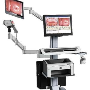 Sistema de Imagenología Digital para Colposcopia en Obstetricia y Ginecología, Cámara de Colposcopia Ginecológica, MEJOR VENTA - Product Image 1