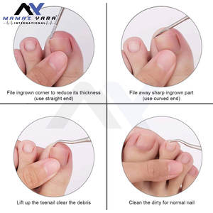 Kit professionnel d'outils pour ongles incarnés, 2 pièces : Repousse-ongles de précision double face en forme de cuillère, Lime à ongles et Nettoyeur de cuticules - Product Image 5