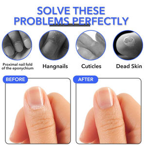 Cortauñas de Acero Inoxidable de Primera Calidad, Duradero, con Apertura de Mandíbula Ancha para Uñas de Manos y Pies, Herramienta Profesional para Salón, Precio Razonable - Product Image 4