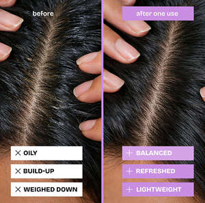 Champú Sólido Clarificante, Limpieza Profunda del Cuero Cabelludo, Control de Grasa, Cuidado del Cabello, Champú Natural Sólido para un Cabello Saludable - Product Image 5