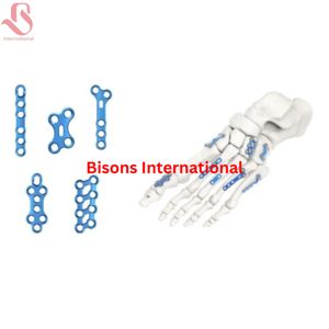 ชุดเครื่องมือผ่าตัดกระดูกข้อเท้าและเท้าแบบไทเทเนียมสำหรับขายส่ง สำหรับการผ่าตัดกระดูกและข้อและศัลยกรรมกระดูกหัก - Product Image 5