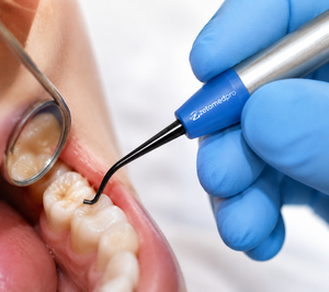 Instrumento Dental Restaurador de Acero Inoxidable de Doble Extremo Liso Posterior Zetomed Pro - Product Image 2