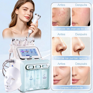 Equipo <span class=keywords><strong>de</strong></span> Limpieza Facial Profesional Multifuncional para Spa - Product Image 4