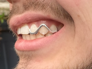 Grillz dentaire en argent sterling 925 massif, style hip-hop, bijou dentaire unisexe, pour usage quotidien, capuchon dentaire en métal - Product Image 2
