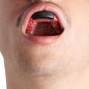 Protector Bucal Premium de EVA con Diseño Antideslizante para Boxeo y Kickboxing, Ofrece Comodidad, Transpirabilidad y Fuerte Resistencia a Impactos - Product Image 5