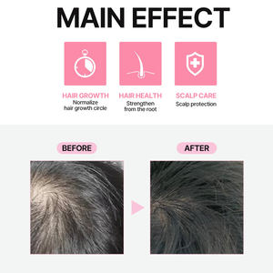 Aceite para el Crecimiento del Cabello con BIOTINA Aceite de Polygonum Marca Privada Tratamiento Capilar Vegano Ampolla para el Cuidado del Cuero Cabelludo VITAMINA B7 Pérdida de Cabello FRIJOL NEGRO Corea - Product Image 4