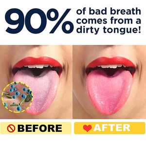 Limpiador de Lengua de Cobre Ligero con Diseño de Borde Suave para una Higiene Bucal Fácil y Efectiva a Precio de Mayoreo - Product Image 5