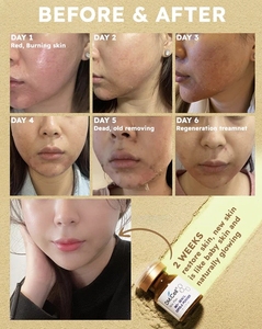 Kit de poudre DM.CELLBio Seacil Expola pour le visage K-Beauty Fabriqué en Corée - Product Image 2