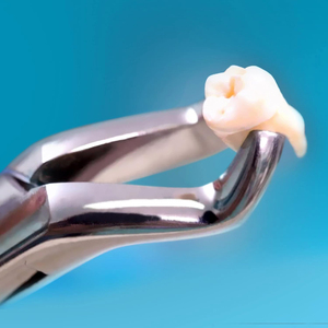 Pinzas de Extracción Dental de Alta Resistencia #   150 #   151 #   Pinzas Apicales 23, Pinzas Cowhorn, Molares Inferiores, Atraumair 3 Piezas - Product Image 5
