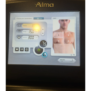 Diodo Láser de Platino ALMA Soprano ICE 2021 - Product Image 5