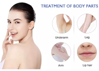 Alat Penghilang Bulu Laser Diode Vilase VCSEL untuk Penggunaan di Rumah, 3 Gelombang, Tanpa IPL