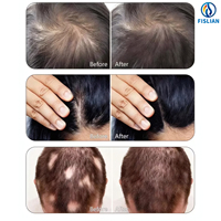 Analyseur de cuir chevelu professionnel pour salon de coiffure, 5 modes, caméra HD, détecteur d'humidité cutanée, usage commercial US
