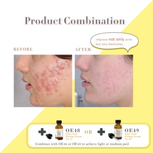Gel exfoliant éclaircissant professionnel végétalien OEM 35% AHA Acide glycolique pour le visage et le corps - Product Image 2