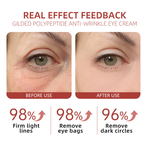 La Crema Contorno de Ojos Antiarrugas con Péptidos Dorados Hidrata y Nutre los Ojos, Reduce las Líneas Finas, las Ojeras y la Hinchazón - Product Image 3
