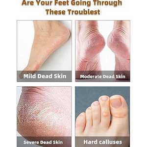 Removedor de Callosidades Avanzado para Pies SHEARS BEAUTY SB-FCR-705 con Cabezales de Rodillo Reemplazables, Duradero, Calidad de Salón A+, para Pedicura en Casa - Product Image 6