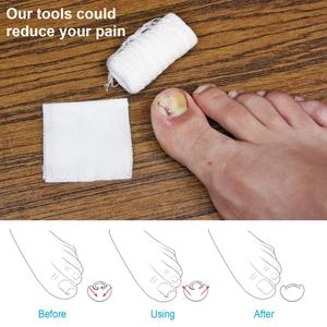 Corrector de Uñas Encarnadas Mecánico Premium de Acero Inoxidable, Levantador de Doble Gancho, Acabado Dorado y Plateado, Profesional, para Niños y Adolescentes - Product Image 6