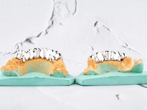 Grillz de luxe en moissanite, bijoux dentaires personnalisés style hip-hop haut de gamme, plaqué argent rhodié - Product Image 4