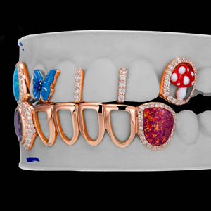 Grillz dentaire de luxe Hip Hop personnalisé en argent 925 plaqué or, serti de moissanite - Product Image 2