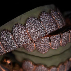 Ensemble de grillz hip-hop de luxe en or rose avec diamants Moissanite, grillz dentaires personnalisés entièrement sertis de Moissanite VVS, bijoux de style rappeur - Product Image 2