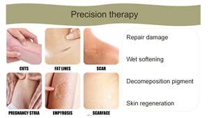 Usine vendant le meilleur ruban de <span class=keywords><strong>silicone</strong></span> feuilles de gel médical traitement de retrait de <span class=keywords><strong>cicatrice</strong></span> de plâtre de <span class=keywords><strong>pansement</strong></span> réutilisable - Product Image 5