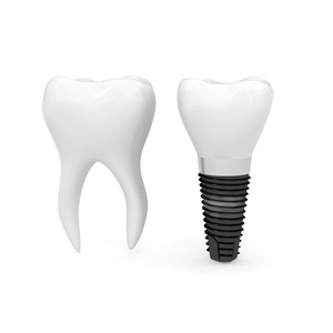 Complete Dental Implant Instruments <b>Set</b> Professional Oral Surgery Implant Kit with Precision Drill System and Surgical - Product Image 6