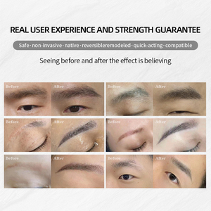 Extensiones de Cabello Humano y Extensiones de Pestañas y Cejas con Nueva Tecnología para Trasplante de Cejas - Product Image 4