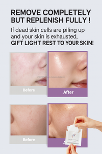 Pad Esfolianti Coreani K-Beauty OEM con PHA e LHA a Bassa Irritazione per una Pelle Luminosa, Booster Essenza per una Pelle Effetto Vetro - Product Image 6
