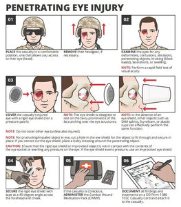 Protector Ocular de Acero Inoxidable, Esterilizado y Ventilado, Maleable, para Protección Oftálmica, Desechable, de Un Solo Uso, para Microcirugía - Product Image 5