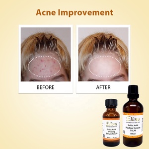 Sérum Exfoliant Liquide à l'Acide Salicylique 30% B.H.A pour Estomper les Taches Brunes et Soin des Pores OEM - Product Image 3