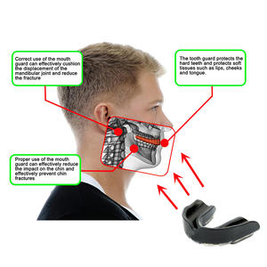 Protector Bucal Personalizado UBEST, Ajuste Delgado, para Boxeo, Baloncesto, Lacrosse, Fútbol, MMA, Artes Marciales y Hockey - Product Image 2