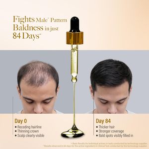 Suero para el Crecimiento del Cabello, Suero Nutritivo para Cabello Fino, Prueba Clínica de 84 Días - Product Image 3