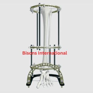 Sistema de Anillo y Marco de Fijación Externa Ilizarov de Acero Inoxidable BISONS para Cirugía de Trauma y Ortopedia - Product Image 2