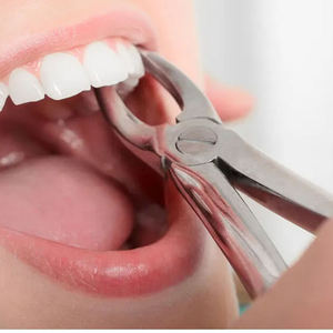 Pinzas de Acero Inoxidable Reutilizables de Alta Calidad para Extracción Dental de Molares Inferiores en Animales Grandes, con Certificación CE, de Grip Surgical - Product Image 6