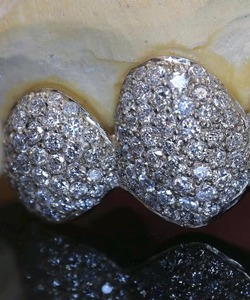 Grillz en diamant très demandés avec moule dentaire personnalisé et finition de luxe pour bijoux de mode, disponibles à prix raisonnable - Product Image 5