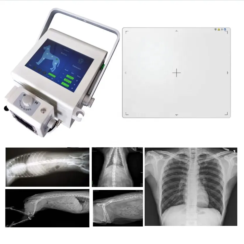 X-Ray Digitale Draagbare X-Ray Machine Met Dr Paneel Voor Radiografie Beeldvorming Diagnose Cijfer Xray Detector