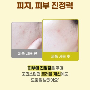 Ampolla Coreana K-Beauty para el Cuidado del Acné, 30 ml, con Propóleo y Centella Asiática, Sérum para el Tratamiento del Acné - Product Image 6