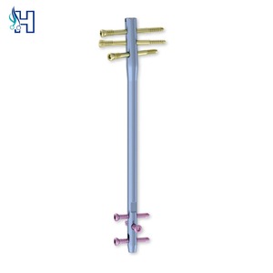 Proveedor de Implantes Ortopédicos: Clavo Tibial Suprapatelar de Bloqueo OEM - Product Image 1