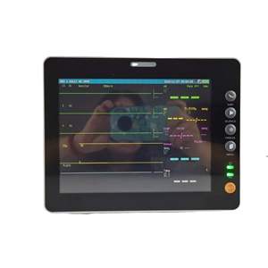 Rsd6000v पालतू क्लिनिक अस्पताल पशु चिकित्सा महत्वपूर्ण संकेत मल्टीपैराट्रो पशु चिकित्सा निगरानी etco2 - Product Image 6