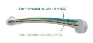 Clavo Intramedular Tibial Suprapatelar de Titanio de Grado Médico de Alto Rendimiento con Construcción Canulada - Product Image 4