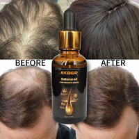 EKBER Etiqueta Privada Orgánica Natural Cuero Cabelludo Pérdida de Cabello Jengibre Biotina Aceite de Botana Aceite PARA EL Cabello 100 Puro Crecimiento de Cabello Crudo