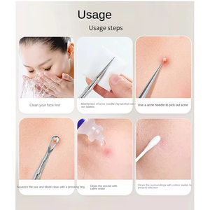 Outil d'élimination des points noirs ultra-fin, pince professionnelle pour points noirs et points blancs, idéal pour les salons de beauté - Product Image 3