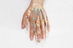 Implantes Ortopédicos de Calidad Superior para Cirugía Básica, Juego de Placas Óseas para Animales Pequeños, Instrumentos Quirúrgicos Veterinarios de Acero Inoxidable - Product Image 3